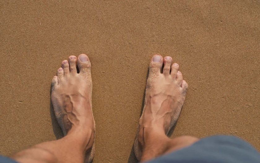 diabetes feet