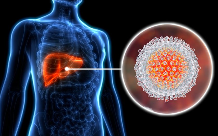 hepatitis C
